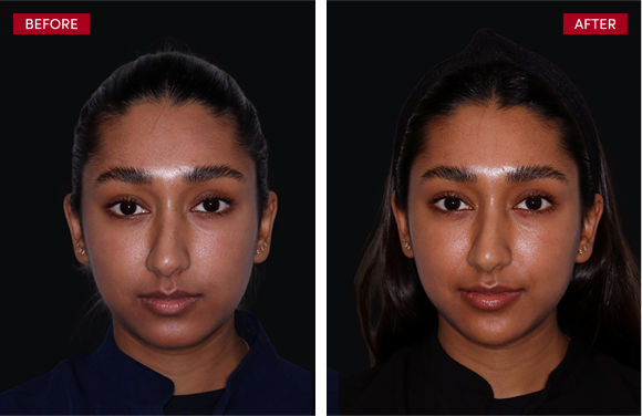 aai-art-of-transformation-1