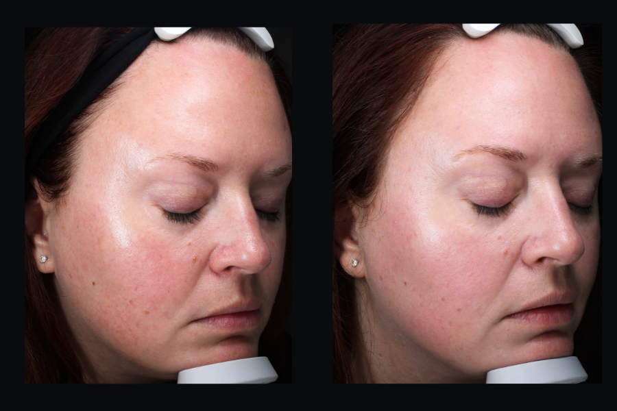 aai-bbl-broad-band-light3