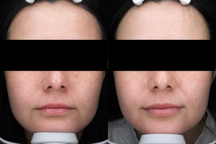 aai-bbl-moxi-one-session