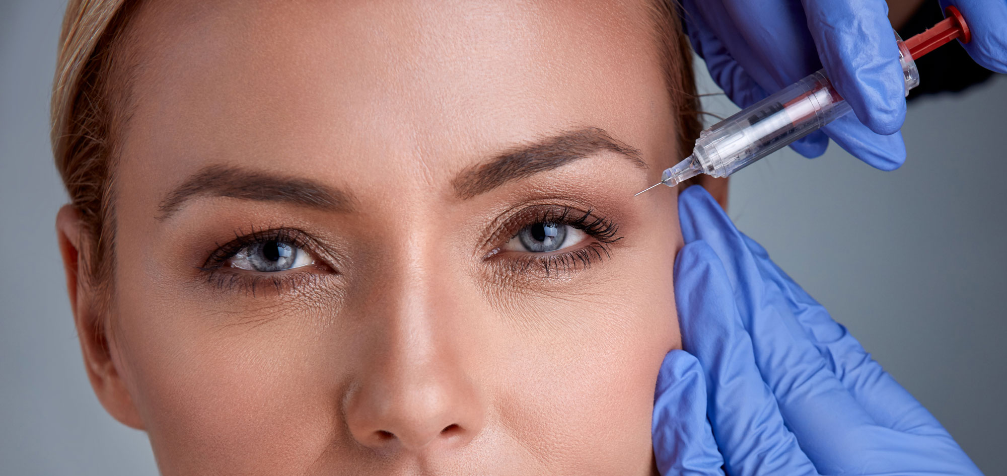 Botox brow lift being performed with precision injections to lift brows and smooth forehead lines