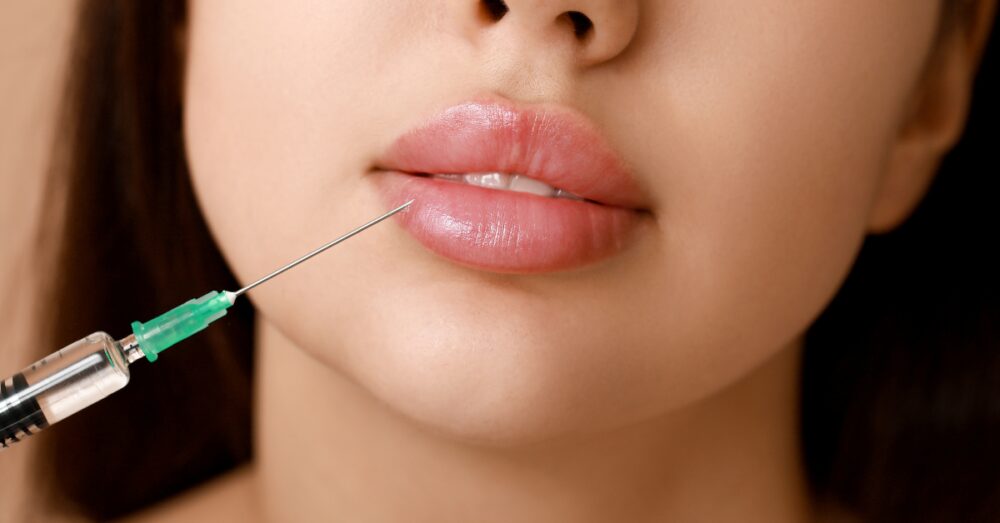 Close-up of a lip filler injection being administered near the lower lip using a fine needle