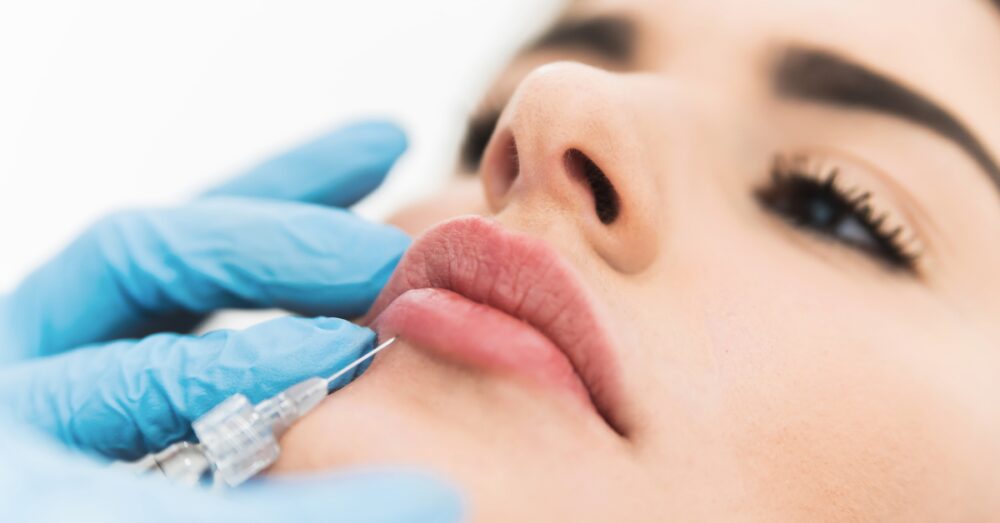Close-up of a lip filler injection being administered with blue medical gloves